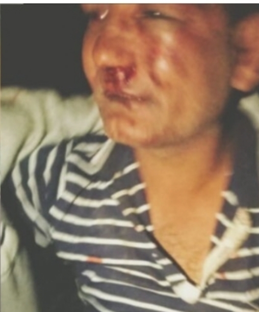 मदिरा पिएका असइ कुटिए