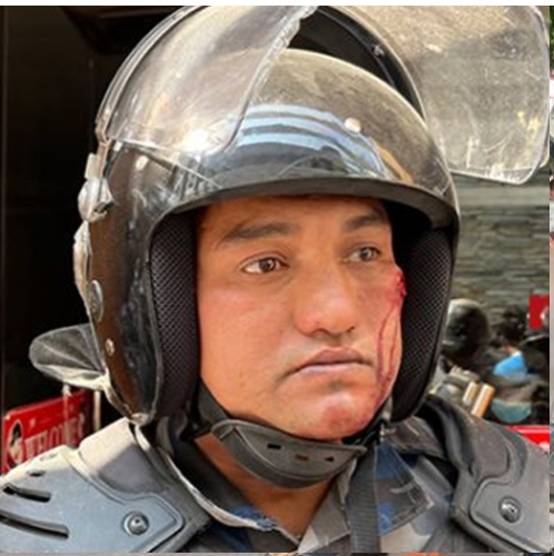 राजावादीले गरेको प्रदर्शनमा झडप हुँदा ७ जना सशस्त्र प्रहरी घाइते